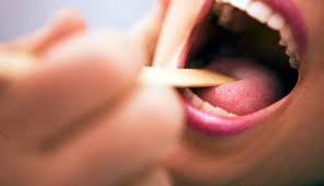 This includes cancers of the throat, tonsils, tongue, mouth, and lip. Q A What You Should Know About Tonsil Cancer Md Anderson Cancer Center