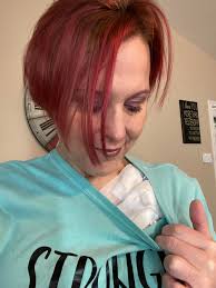 Surgery day, port removal and gtube insertion