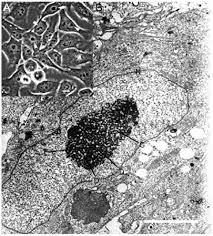 Plant cell through light microscope. The Nucleolus Reviewing Oldies To Have New Understandings Cell Research