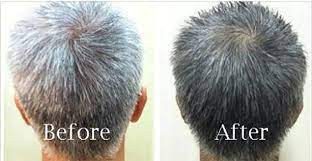 Causes of premature greying of hair. Wheatgrass Turns Gray Hair Back To Its Natural Color Reverse Gray Hair Grey Hair Treatment Hollywood Hair