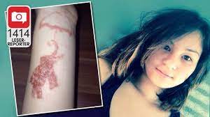 Also known as false henna or black henna, ppd is a highly potent allergen that is commonly used in a number of countries frequented by vacationers. 12 Jahriges Madchen Im Urlaub Veratzt Das Hat Das Henna Tattoo Mit Meinem Arm Gemacht 1414 Leser Reporter Bild De