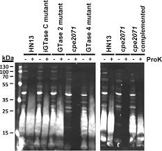 The actress christine neubauer poses at the 24th rtl spendenmarathon wir helfen kindern 2019. An Atypical Lipoteichoic Acid From Clostridium Perfringens Elicits A Broadly Cross Reactive And Protective Immune Response Journal Of Biological Chemistry