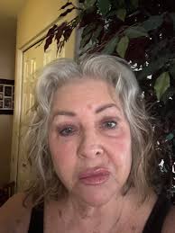 Introduction and photo sharing in kidney transplant community