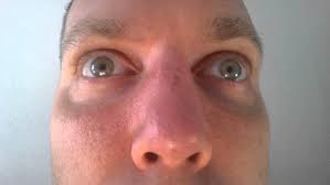 Spinning my eyes in circles