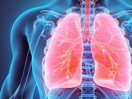 Seyed bashir mirtajani et al, geographical distribution of cystic fibrosis; Mukoviszidose Durchbruch Bei Der Behandlung Ndr De Ratgeber Gesundheit