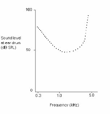 Sensorineural Hearing Loss Wikipedia