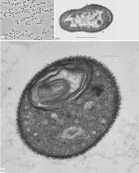 A generalised animal cell as observed under an electron microscope. Cell Morphology And Ultrastructure Of The Strain De Cell Morphology Download Scientific Diagram