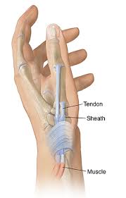 Tendon sheaths in the hand should be studied in the textbook. Understanding De Quervain Tenosynovitis