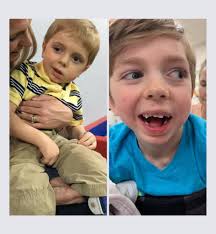 Wyatt's miraculous recovery from brain damage