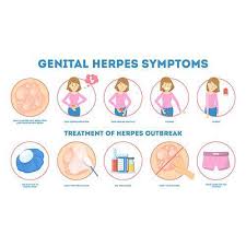 Image result for genital herpes