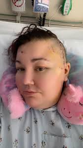 Did they do Brain surgery