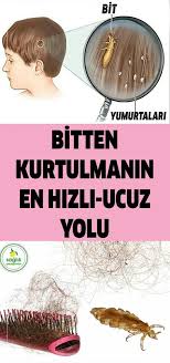 Bu Yontemi Cok Az Doktor Biliyor Bitten Kurtulmanin En Hizli Ucuz Ve Kolay Yolu Bit Cozum Cocuk Kadin Okul Doctor For Kids Natural Mask Body Health