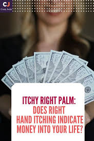 Itchy Right Palm Does Right Hand Itching Indicate Money Into Your Life Itch Itchy Life
