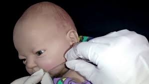 Canalización de vía venosa periférica en el recién nacido. 2021