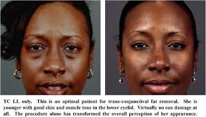 Image result for Blepharis transvaalensis