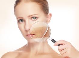 ¿qué es el paño o melasma? Manchas En La Cara Tipo Melasma Ribe Clinic