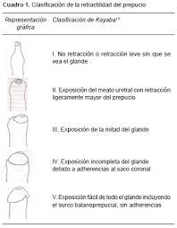 Estudio Retrospectivo Del Efecto Del Furoato De Mometasona Al 0 1 En El Tratamiento No Quirurgico De Fimosis Y Adherencias Prepuciales En Ninos Mexicanos