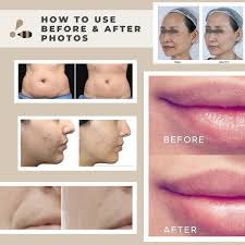 Certified marketing and business development company for medical aesthetics. Chobee Marketing Md Home Facebook