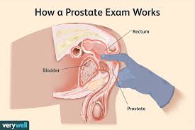 What Is a Prostate Exam? Purpose and What to Expect