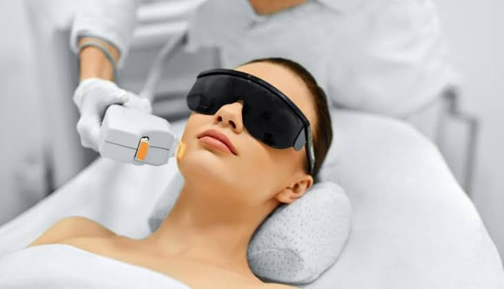 IPL Treatment
