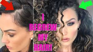 Treatments for the various forms of hair loss have only moderate success. How I Stopped My Hair Loss With Low Level Laser Therapy The Glam Belle Youtube