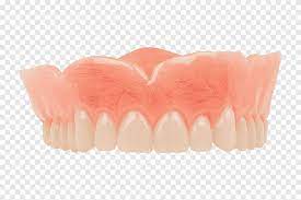 Maybe you would like to learn more about one of these? Gigi Tiruan Gigi Kedokteran Gigi Implan Gigi Lainnya Aneka Lainnya Png Pngegg