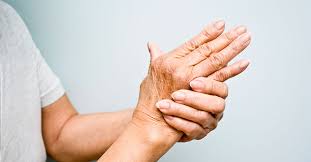 Rheumatoid Arthritis Treatment Carolina Arthritis