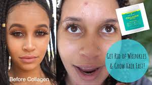 The collagen food grade contain beneficial active ingredients that boost users' health status and wellbeing. Further Food Collagen Peptides The Benefits How To Use Reduce Wrinkles Grow Hair Youtube