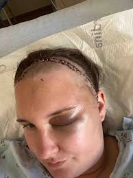 Fundraiser for Monica Winkelmann by Meagan Anderson : Monica's Medical Fund