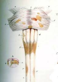 La esclerosis múltiple es una enfermedad autoinmune, que afecta al sistema nervioso central, cerebro, médula espinal y tronco del encéfalo. Esclerosis Multiple Wikipedia La Enciclopedia Libre