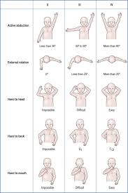 Check spelling or type a new query. Clinical Presentation And Considerations Of Neonatal Brachial Plexus Palsy Musculoskeletal Key