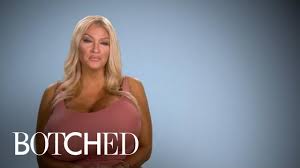 Allegra Explains Her Growing Giant Breasts | Botched | E! - YouTube