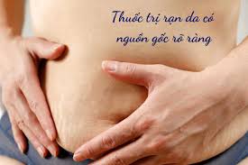 Bí quyết chọn thuốc trị rạn da chị em nhất định phải biết