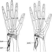 Fdp tendons help bend the index, . Left The Emp Originating In The Forearm And Inserting Into The Dorsal Download Scientific Diagram
