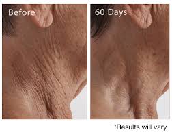 Maybe you would like to learn more about one of these? Crepe Erase Reviews Don T Buy Before Reading This 2021