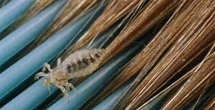 Following is how you can use mayonnaise to get rid of head lice: 20 Best Lice Treatments How To Kill Head Lice Health Com