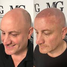 38 popular hairline tattoo ideas to get inked in style gorgeous tattoos hairline tattoos neck tattoo. Mike Gunner Hairline Tattoos Smp Home Facebook