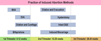 Aborto Quirurgico Wikipedia La Enciclopedia Libre