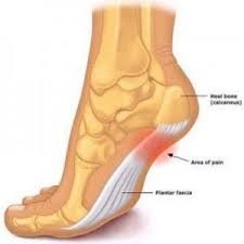 Pin On Health