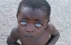 Discover why some black Africans have blue eyes - Afrinik