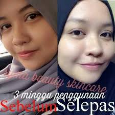 Syma beauty skincare hq, kelantan. Hermosa E Shop Satriakatenne Profile Pinterest