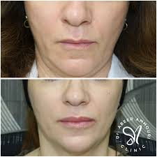 Dr.Abeer Ammouri (@dr_abeerammouri) • Photos et vidéos Instagram