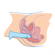 The path to relaxed anal sex