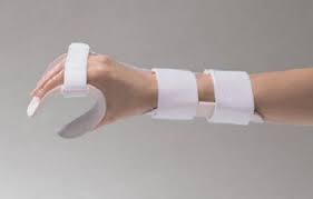 Resting Hand Splint Used With Inflammatory Conditions Such As Ra Places The Wrist In 10 30 Degrees Extension Thumb In Pabd Mp S At 15 25 Degrees Flexion And