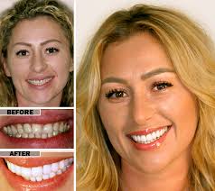 8048 market street • suite a, charleston place • wilmington, nc • between ogden and porter’s neck. Cosmetic Dentistry In Brooklyn Ny Envy Smile Dental Spa