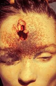 Characteristics of firearms and gunshot wounds as markers of suicide. Honghs0206 Honghs0206 Profile Pinterest