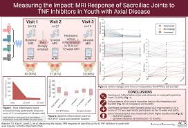Image result for TNF Inhibitor