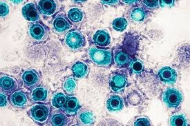 Image result for Herpes Simplex Virus Testing