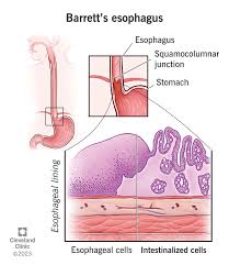 Image result for esophagus