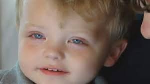 Laundry detergent pods linked to more burns of kids' eyes